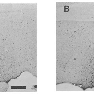 Sex Differences In Immunostaining Intensities Photomicrographs Of