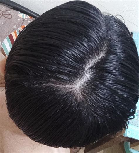 This guide explains the science behind hairstyles for balding guys 3