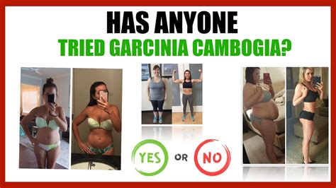 Garcinia Cambogia Before And After Results Has Anybody Tried Garcinia