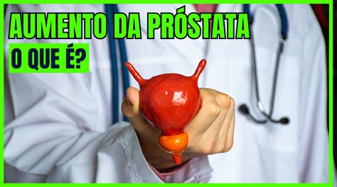 O Que A Prostata Faz - O que é o aumento da próstata? - Dr. Eduardo Gröhs