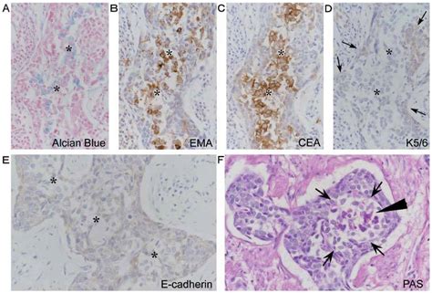 Histochemical And Immunohistochemical Findings Of The Primary