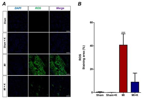 Intracellular Reactive Oxygen Species Ros Level A Representative