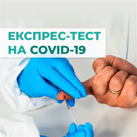Як проводиться експрес-тест на коронавірус - Medstar