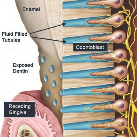 hydrodynamic theory ﬂuid theory Dental Dental hygiene school