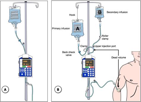 Pdf Multiple Intravenous Infusions Phase 2b Laboratory Study