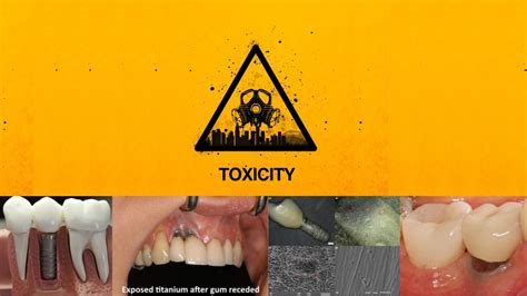 Titanium Toxicity - Zeramex USA