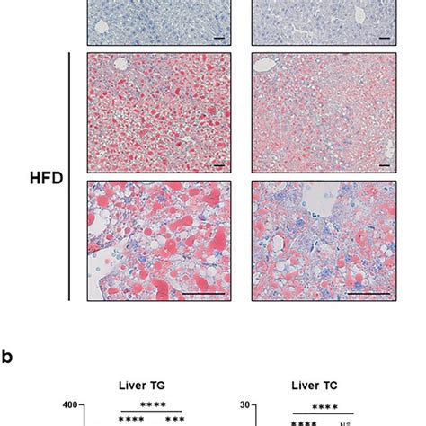 Hfd Induced Hepatic Lipid Accumulation Was Attenuated In Fd Ko Mice