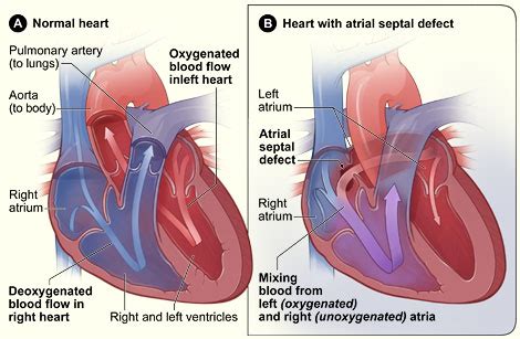 Basics things to know about Heart Hole