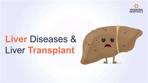 Best Liver Transplant Hospital In Hyderabad Liver Transplant Surgeons