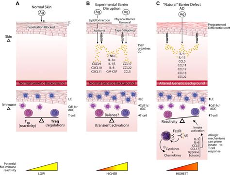 Atopic Dermatitis Results In Intrinsic Barrier And Immune Abnormalities