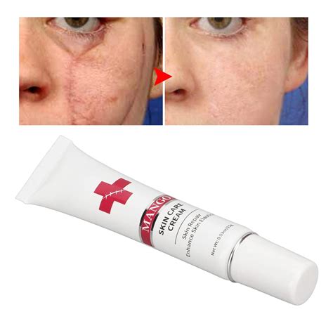 Nourishing Plant Based Scar Cream for Safe & Gentle Scar Repair | Buy