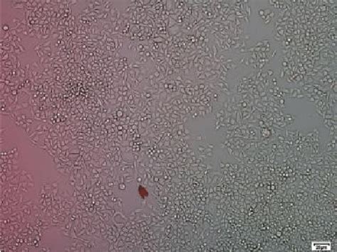 Hela Cells Cultured With 24 Well Plastic Culture Plate Hela Cells Grew