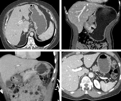 Ct Quick Guides Ct Scanning