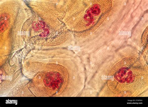 Polytene Chromosomes Of Chironomus Salivary Gland Cells