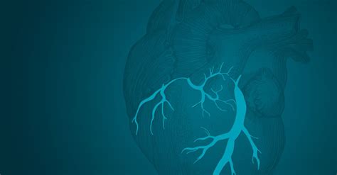 Journal Of Cardiovascular Emergencies On Linkedin Multiple Implantable