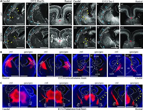 Loss of BIG1 causes defects in axonal projection, axonal pathfinding ...