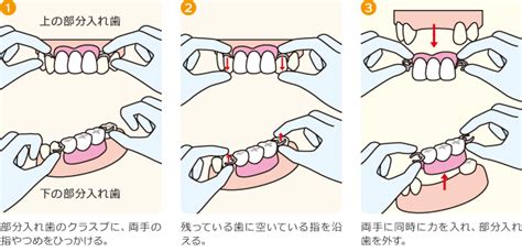 外し方 はじめようやってみよう 口腔ケア