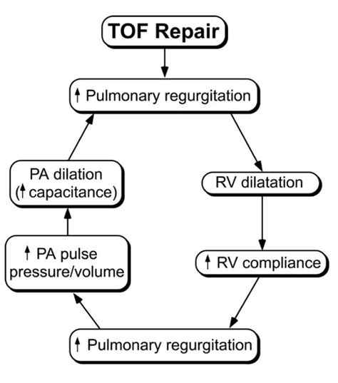 Pulmonic regurgitation pathophysiology - wikidoc