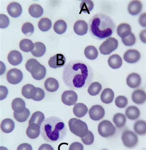 Wbc Morphology Flashcards Quizlet