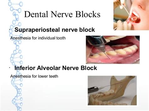 Dental Emergencies