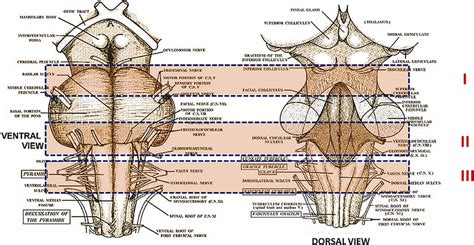 Schematic Representation Of The Brainstem Sampling On The Left