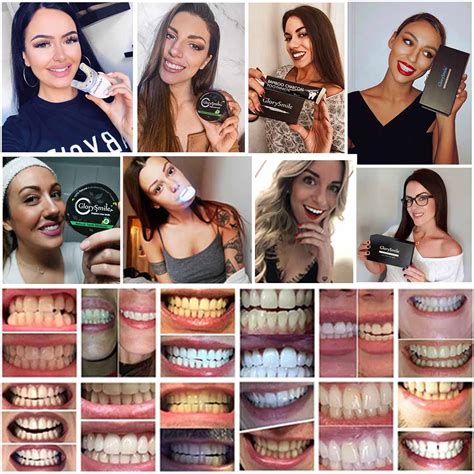 GlorySmile - Teeth Whitening Products - GlorySmile - Teeth Whitening ...