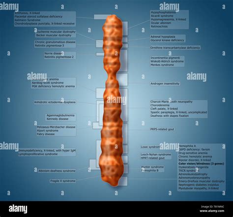 Color Blindness On X Chromosome Illustration Stock Photo Alamy