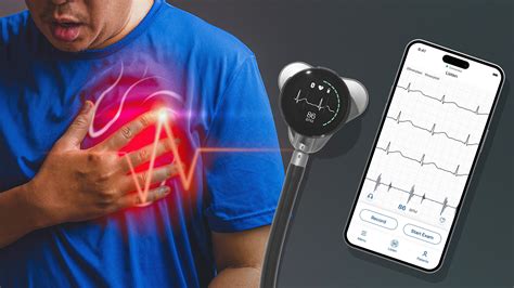 Eko Health’s Digital Stethoscope is Transforming Cardiac Diagnostics
