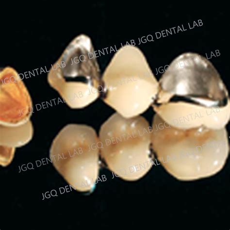 Precious And Non Precious Metal Dental Co Cr Alloy Crown And Bridge In