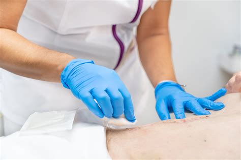 Online Appointment Scheduling - United Wound Care Centers
