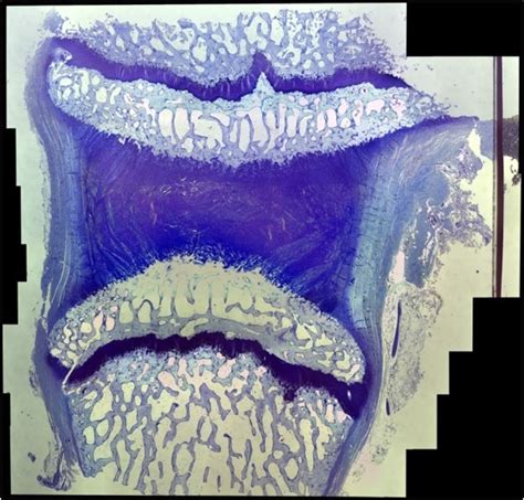 diagram  cartilage quizlet