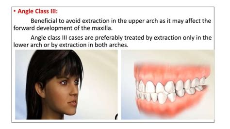 Extractions In Orthodontics Ppt