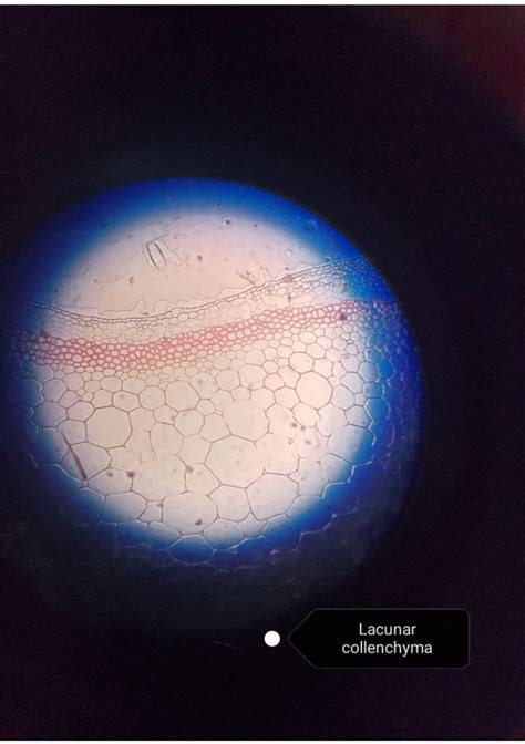 Collenchyma Tissue Lacunar Collenchyma Permanent Simple Tissue In 2022