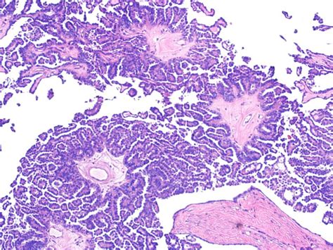 directory pathology pathologyoutlines pathologyoutlinescom