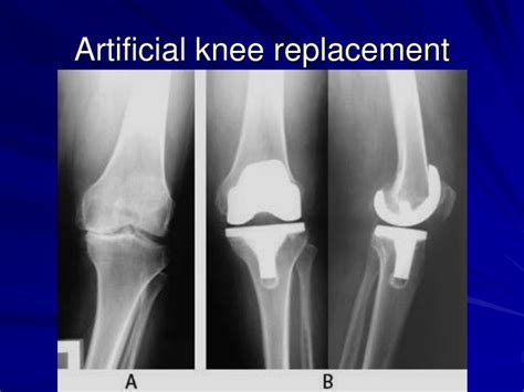 Ppt Lower Extremities Powerpoint Presentation Id2148842