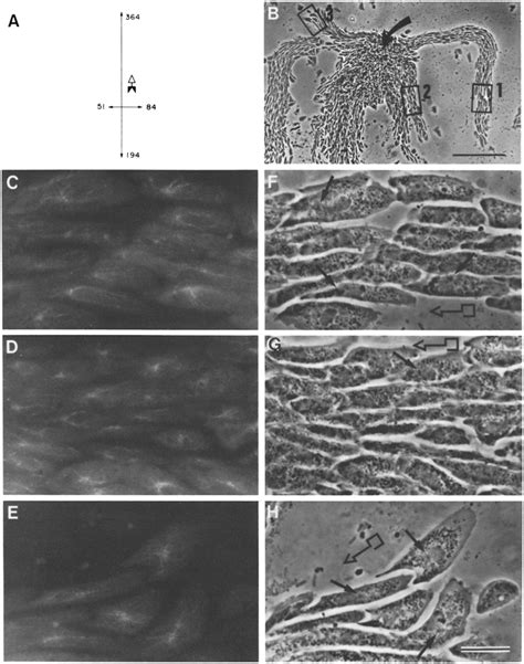 diagram showing  frequency   position  mtoc