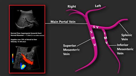 Portal Vein Doppler Sonographic Tendencies