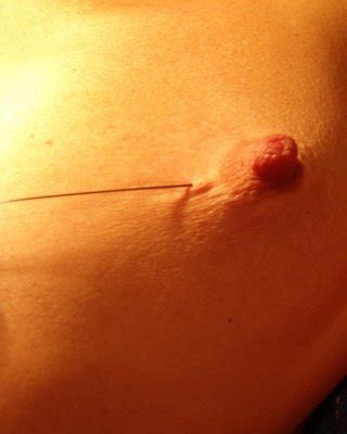 Mature Needle Torture And Breast Skewering Punishment Of German Slavegirl Tri Porn Pictures XXX