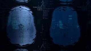 Pure Taboo Perv Doctor Gives Virgin Patient Her First Vagina Exam Xxx Mobile Porno Videos