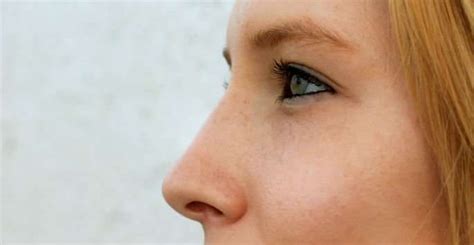 Reduce the Bridge Nose with Rhinoplasty - Palm Beach Plastic Surgeons