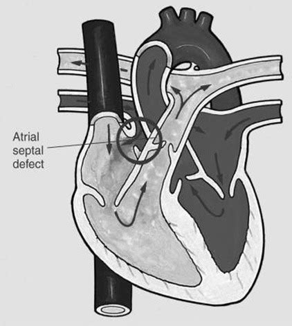cardiovascular flashcards quizlet