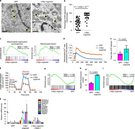 Excessive mitochondrion–ER coupling in c-Myc organoids a,... | Download ...