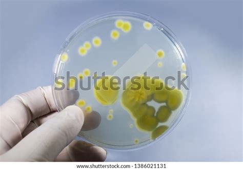 Colonies Penicillium Fungi Grown On Sabouraud Stock Photo 1386021131