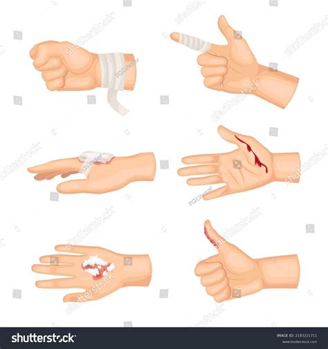 Hands With Different Types Of Wounds Cartoon Royalty Free Stock