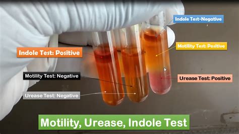 Motility Urease Indole Test Uses Principle Composition Procedure