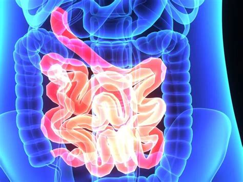 5 Ways To Fight Colon Cancers