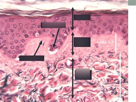 Dermis and hypodermis Diagram | Quizlet