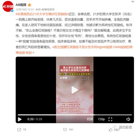 21岁小伙反复发烧后确诊！他以为只有女性才会得这个病系统性周海媚合肥