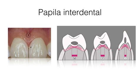 Papila Interdental Odalys Del Valle Pino De Moreno UDocz