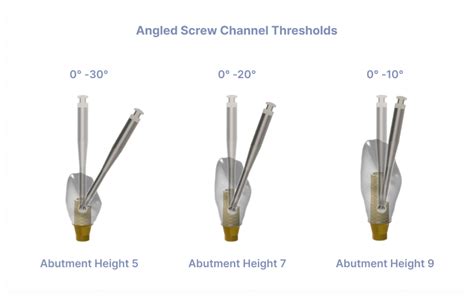 Angled Screw Channel Preat Corporation